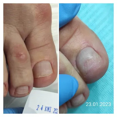 Gabinet podologiczny PODO BeautyJulia Chobanu Podolog